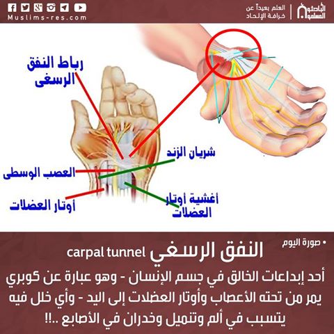 النفق الرسغي